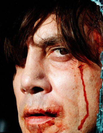 fx transfers-prosthetics